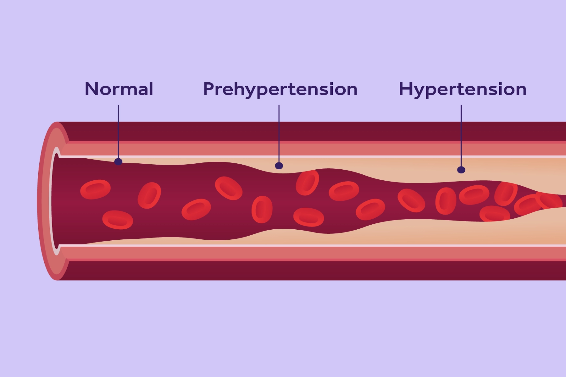 What is blood pressure?