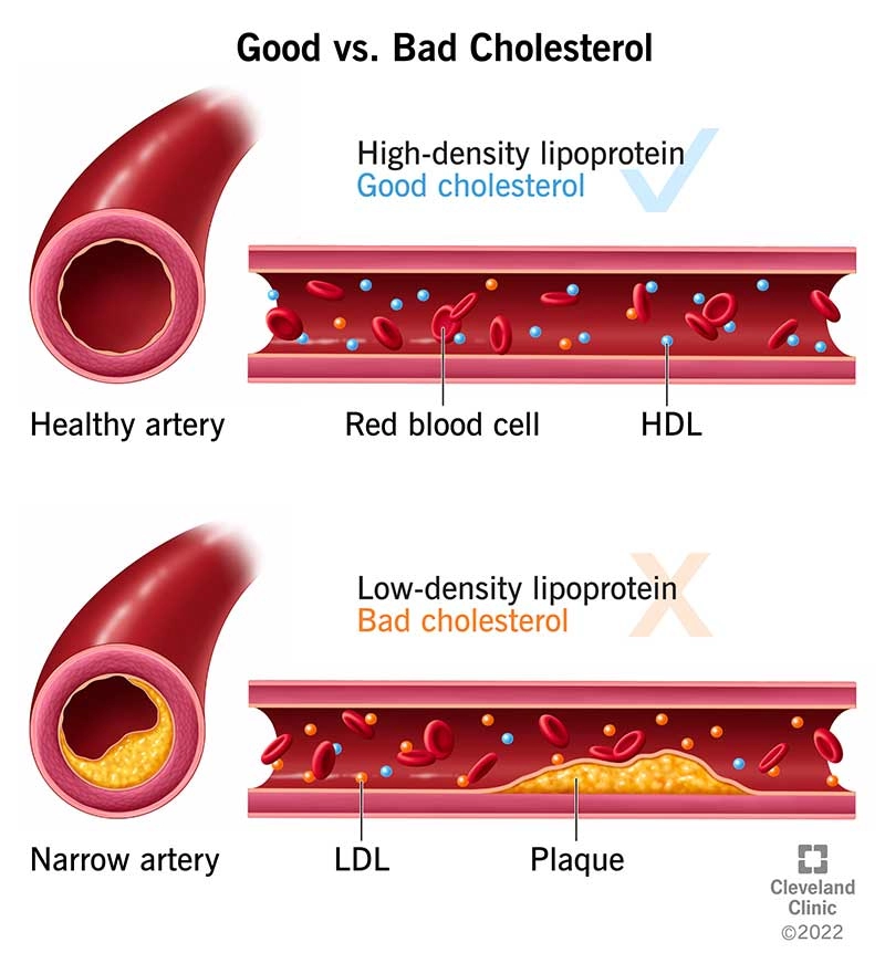 What is cholesterol?